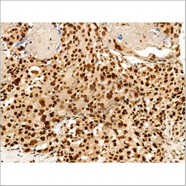 product-image-AAA31352_IHC4.jpg
