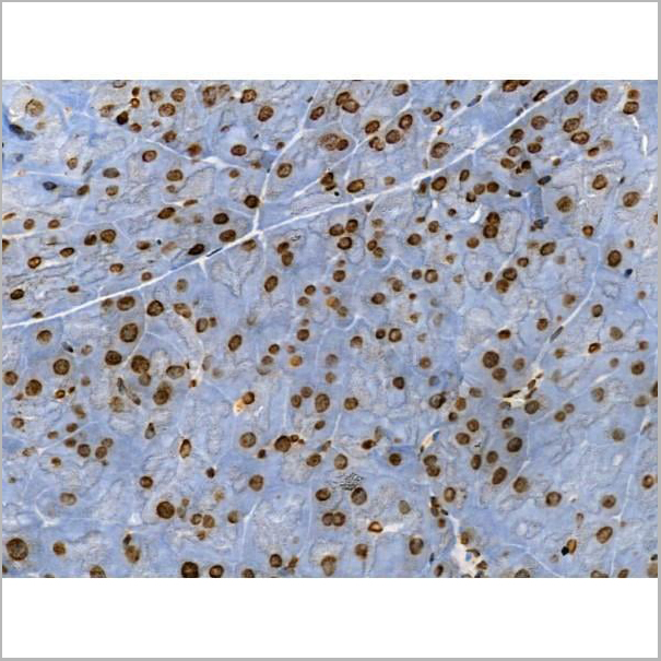 product-image-AAA31353_IHC10.jpg