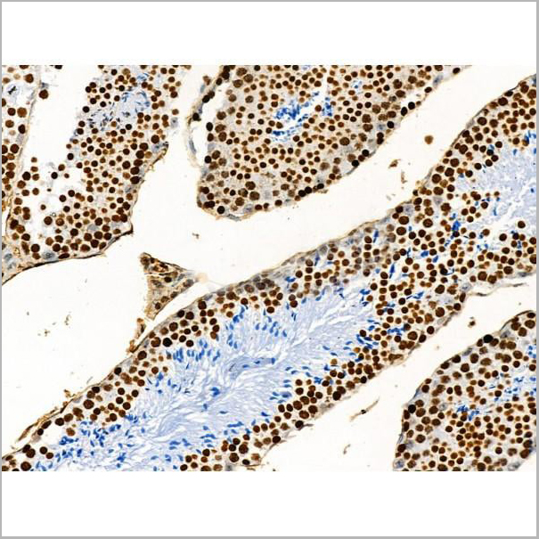 product-image-AAA31353_IHC11.jpg