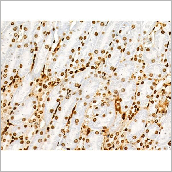 product-image-AAA31353_IHC14.jpg