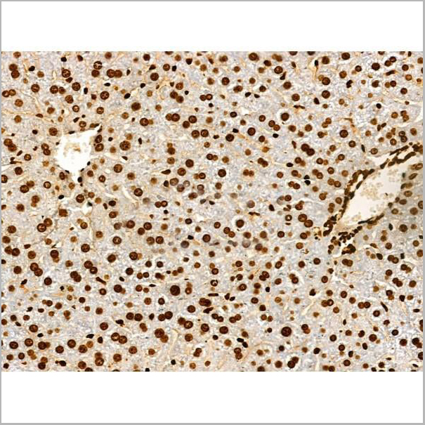 product-image-AAA31353_IHC17.jpg