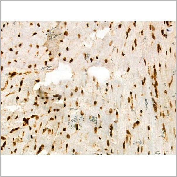 product-image-AAA31353_IHC18.jpg