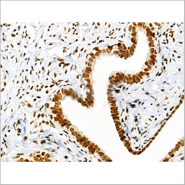 product-image-AAA31353_IHC19.jpg