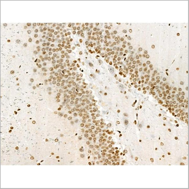 product-image-AAA31353_IHC5.jpg