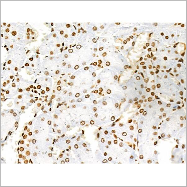 product-image-AAA31353_IHC6.jpg