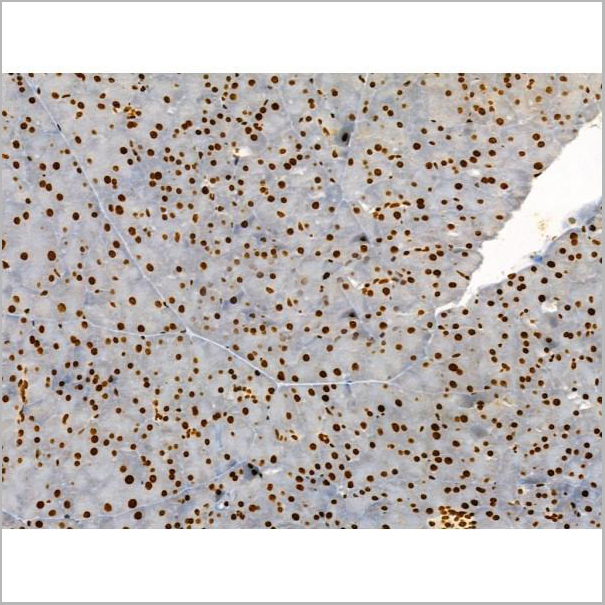 product-image-AAA31358_IHC2.jpg