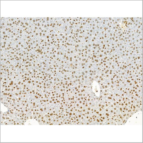 product-image-AAA31358_IHC3.jpg