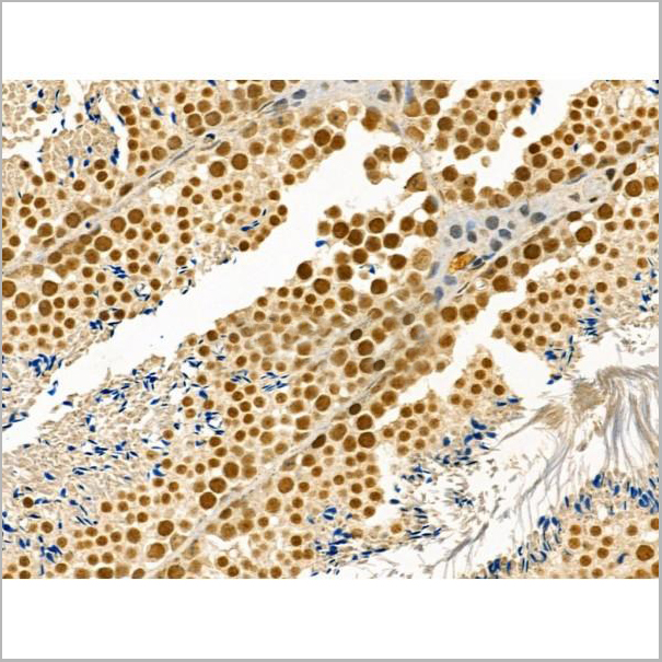 product-image-AAA31362_IHC3.jpg