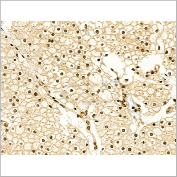 product-image-AAA31362_IHC6.jpg