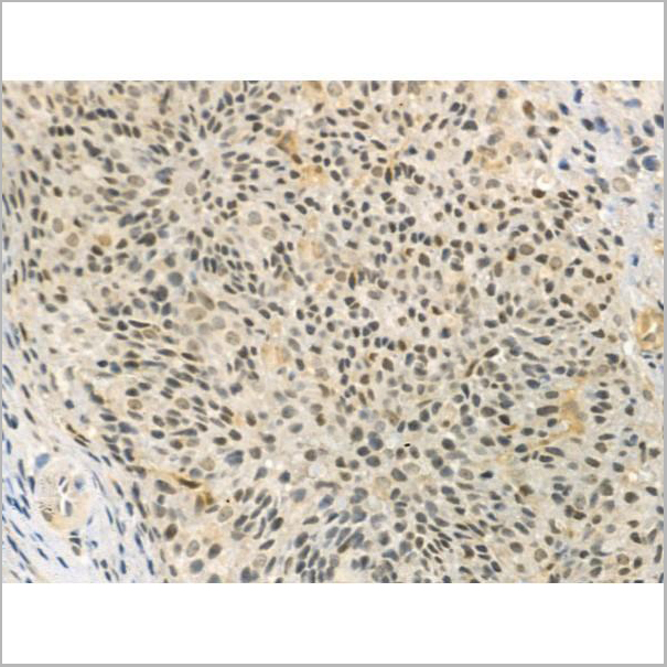 product-image-AAA31367_IHC3.jpg