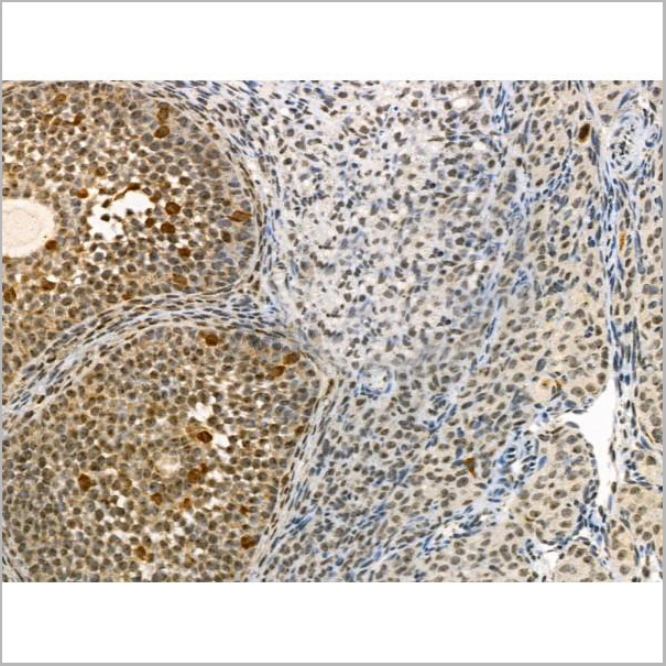 product-image-AAA31367_IHC4.jpg