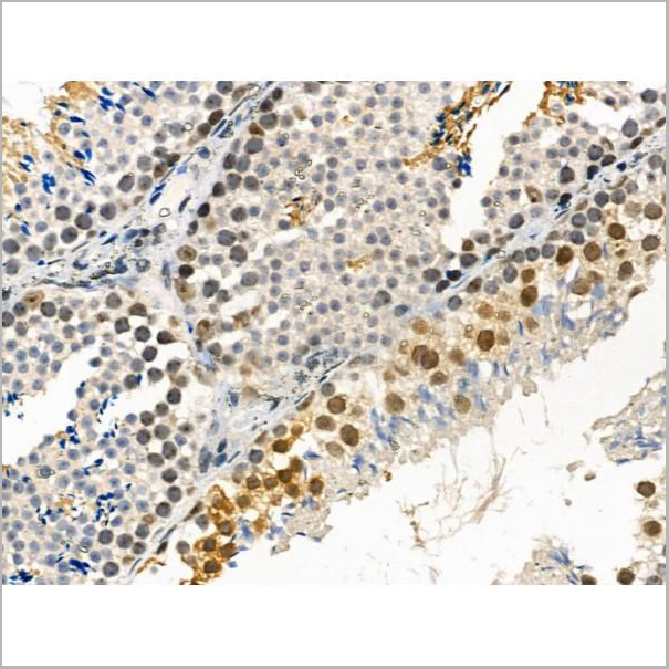 product-image-AAA31367_IHC5.jpg