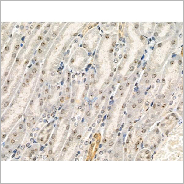 product-image-AAA31367_IHC7.jpg
