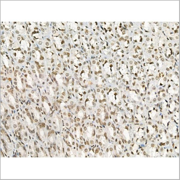 product-image-AAA31368_IHC2.jpg