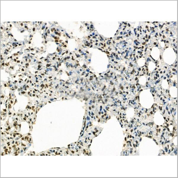 product-image-AAA31368_IHC3.jpg