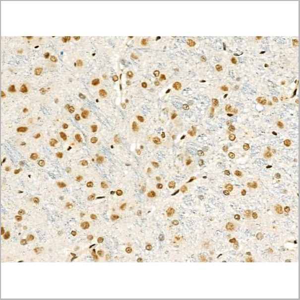 product-image-AAA31369_IHC2.jpg