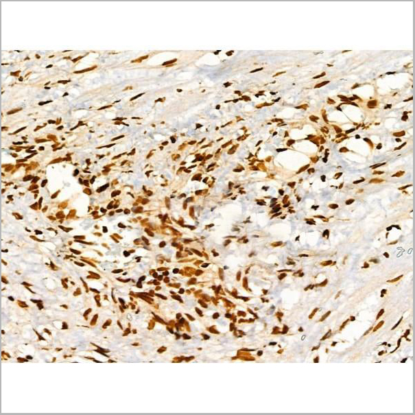 product-image-AAA31369_IHC4.jpg