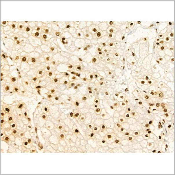 product-image-AAA31369_IHC5.jpg