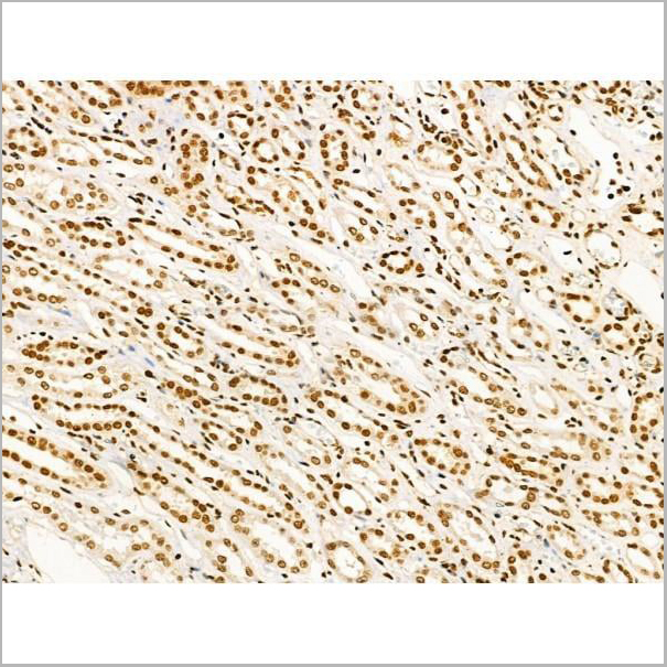 product-image-AAA31369_IHC6.jpg