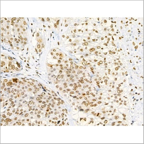 product-image-AAA31369_IHC7.jpg