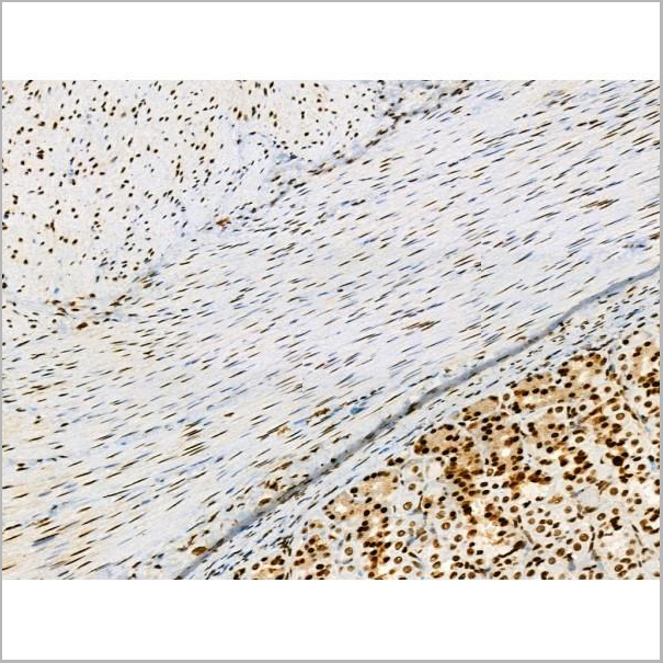 product-image-AAA31370_IHC2.jpg