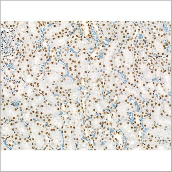 product-image-AAA31370_IHC4.jpg