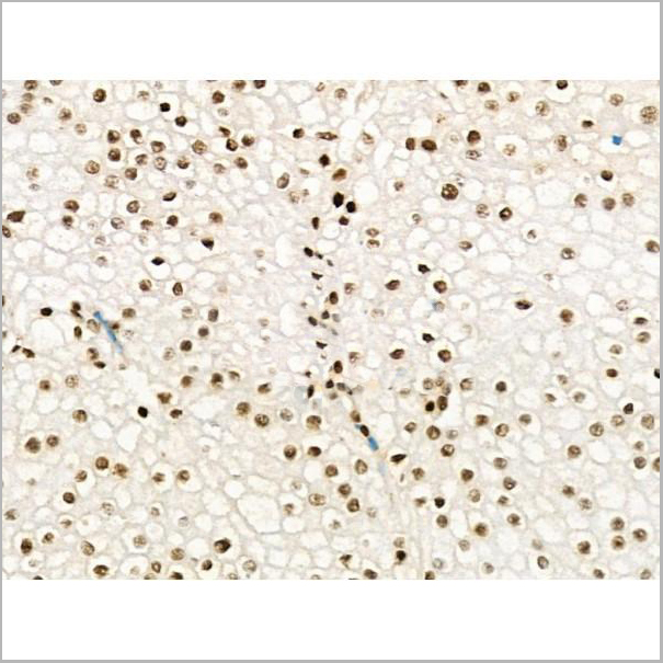 product-image-AAA31370_IHC7.jpg