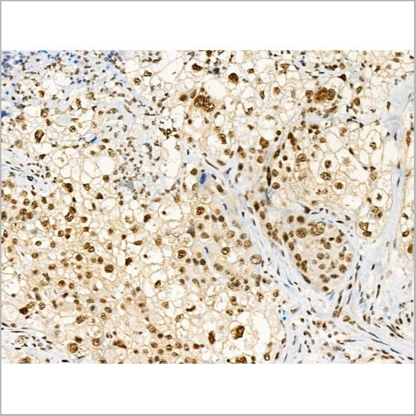 product-image-AAA31370_IHC9.jpg