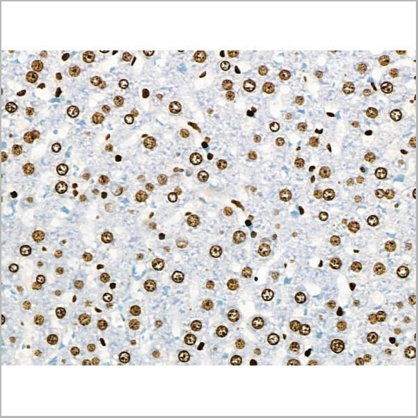product-image-AAA31371_IHC13.jpg