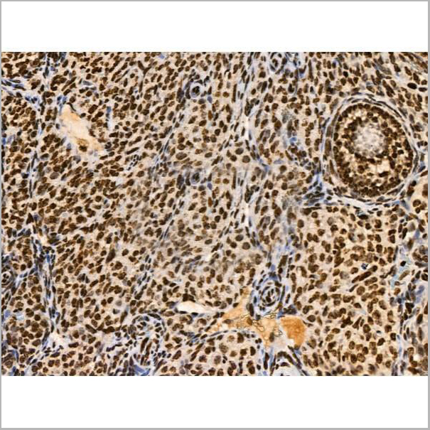 product-image-AAA31371_IHC15.jpg