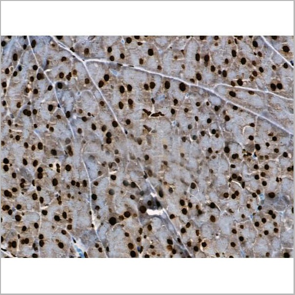 product-image-AAA31371_IHC16.jpg