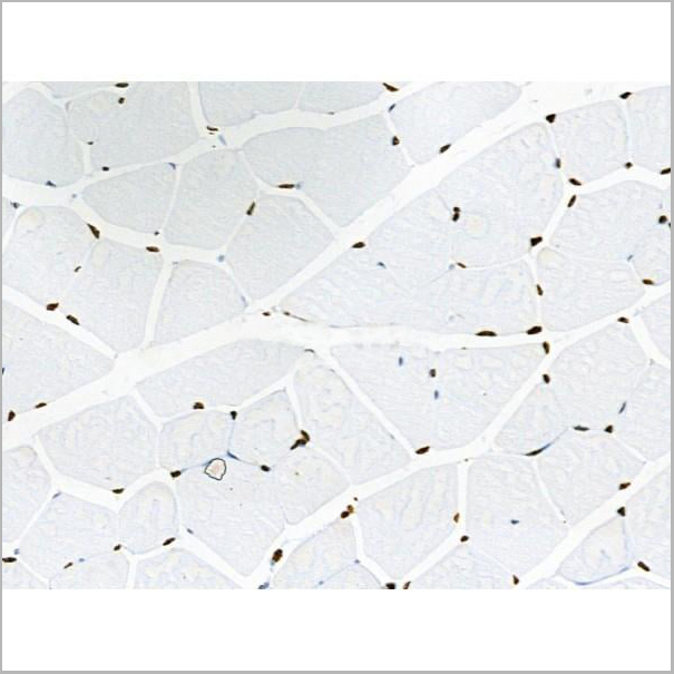 product-image-AAA31371_IHC17.jpg