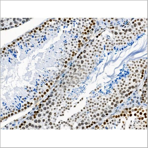 product-image-AAA31371_IHC18.jpg