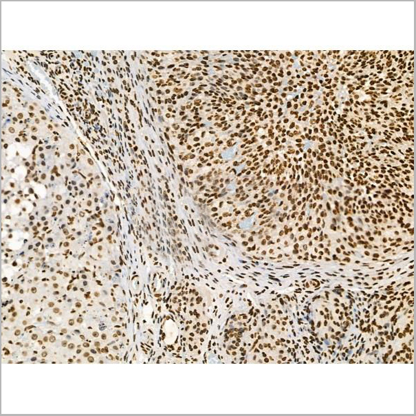 product-image-AAA31371_IHC2.jpg
