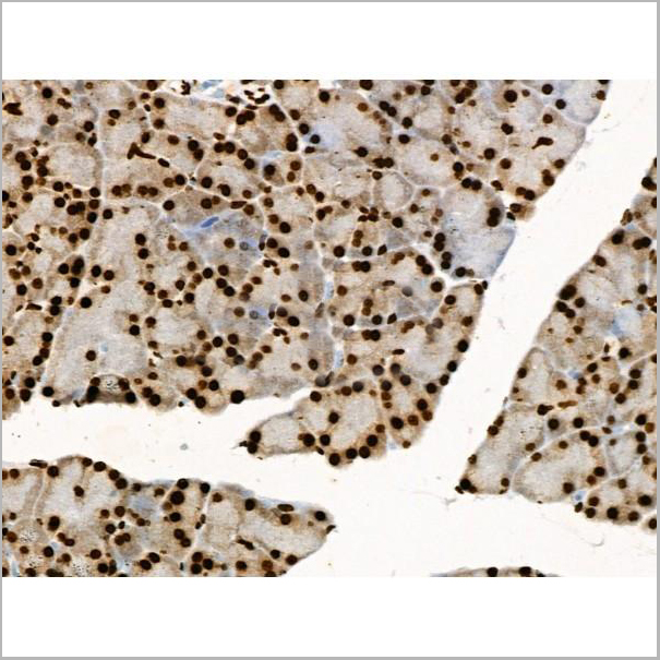 product-image-AAA31371_IHC4.jpg