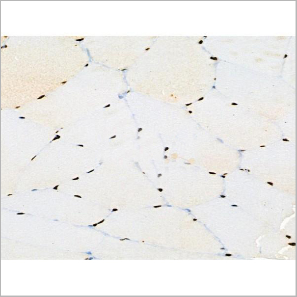 product-image-AAA31371_IHC5.jpg