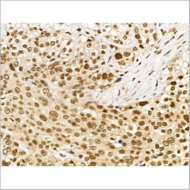 product-image-AAA31372_IHC6.jpg