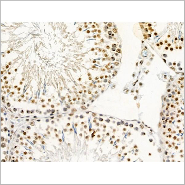 product-image-AAA31375_IHC4.jpg