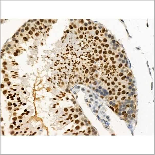 product-image-AAA31375_IHC5.jpg