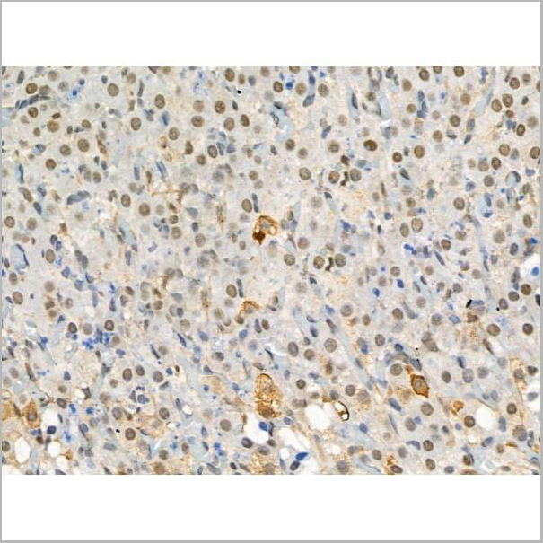product-image-AAA31376_IHC2.jpg