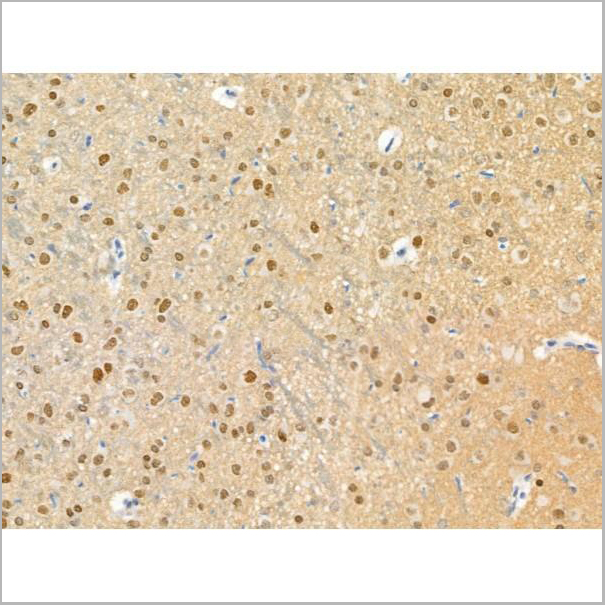 product-image-AAA31376_IHC5.jpg