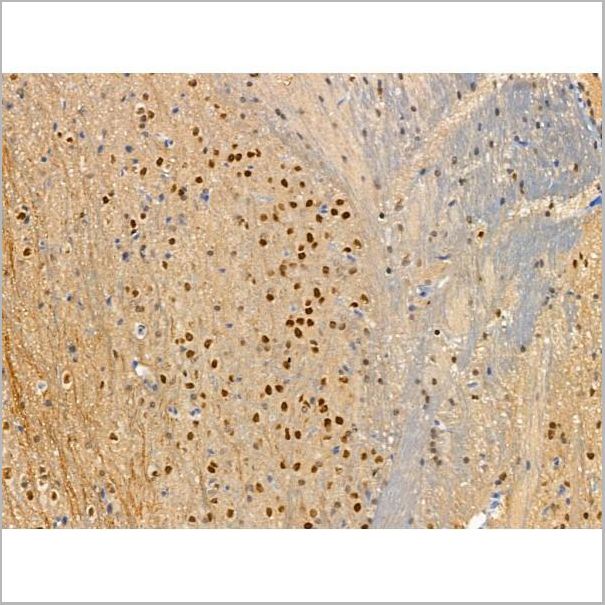 product-image-AAA31376_IHC7.jpg