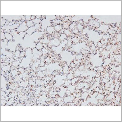 product-image-AAA31382_IHC3.jpg