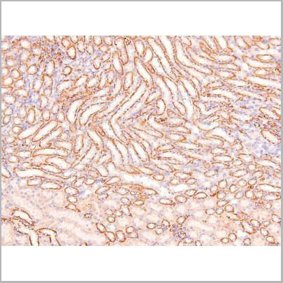 product-image-AAA31382_IHC6.jpg