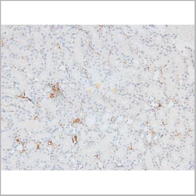 product-image-AAA31394_IHC3.jpg