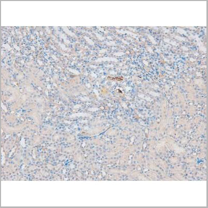 product-image-AAA31394_IHC4.jpg
