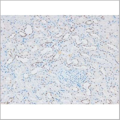 product-image-AAA31394_IHC5.jpg