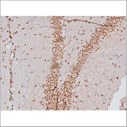 product-image-AAA31403_IHC2.jpg