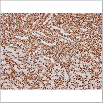 product-image-AAA31403_IHC3.jpg
