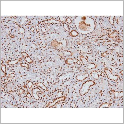 product-image-AAA31403_IHC4.jpg